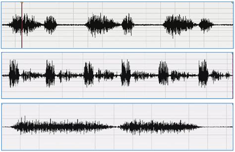 Lung Sound Waveforms Encyclopedia Mdpi