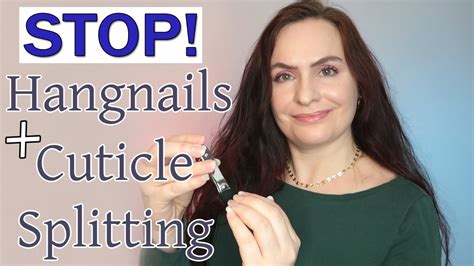 How To Stop Hangnails Cuticle Peeling Splitting Dos And Donts