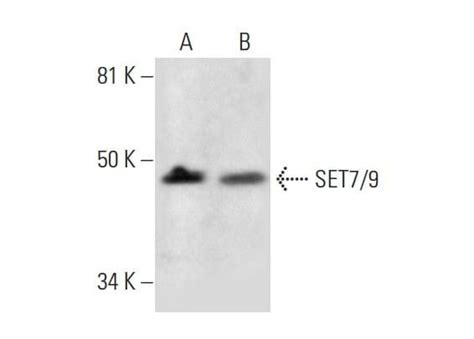 SET7 9抗体 C 11 SCBT Santa Cruz Biotechnology