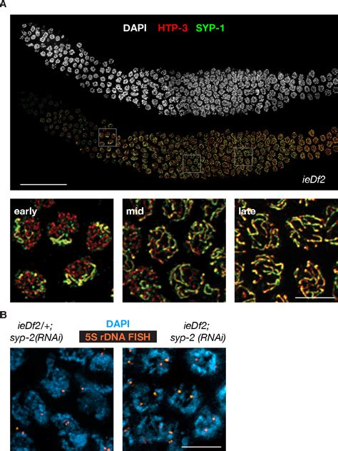 Figure From Pairing Centers Mediate Meiotic Chromosome Dynamics In