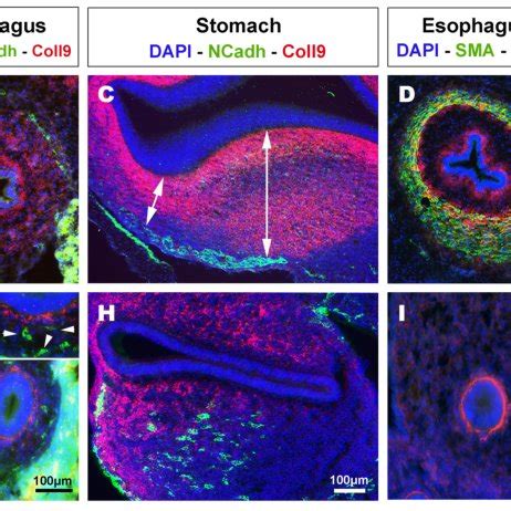 Expression Of Chondroitin Sulfate Proteoglycans CSPG Is Altered In