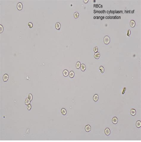 4 Urinalysis Part II Flashcards Quizlet