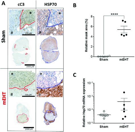 Heat Shock Protein Hsp Expression In Tumor Tissue H After Two