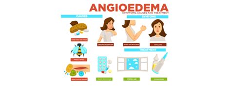 Angioedema: Symptoms, Causes And Treatment