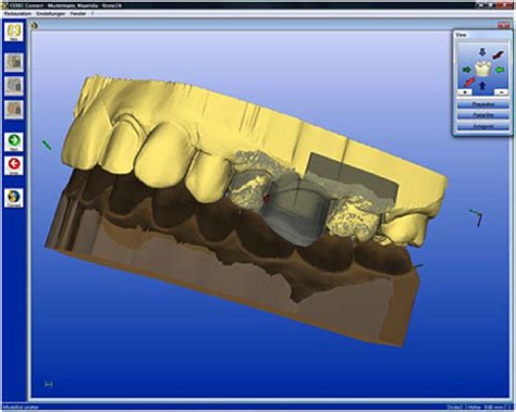 Sirona Launches Intraoral Scanning System And More