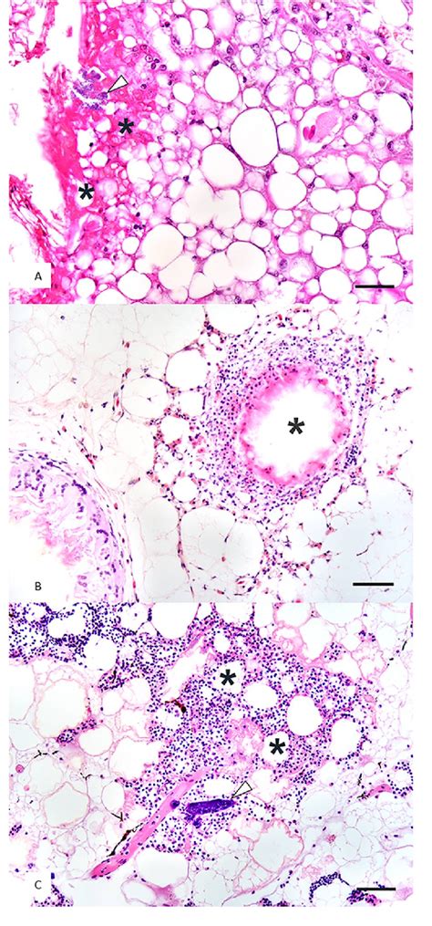 Figure From Steatitis In Cold Stunned Kemps Ridley Sea Turtles