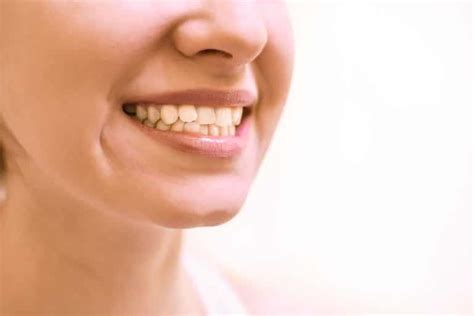 Crooked Teeth In Adults Can Be Caused By Many Things Fortunately Adults Have Options To