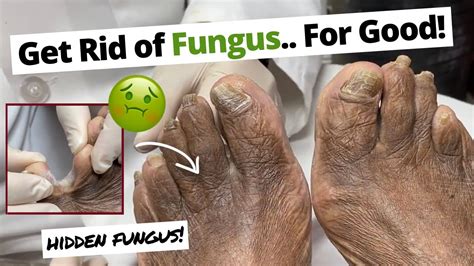 Fungi On Foot