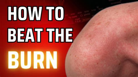 Home Remedies For Heat Rash How To Get Instant Relief