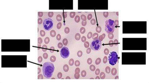 Hematology Flashcards Quizlet