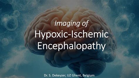 Imaging Of Hypoxic Ischemic Encephalopathy Youtube