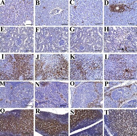 Representative Photomicrographs For Liver Ad Kidney Eh Spleen