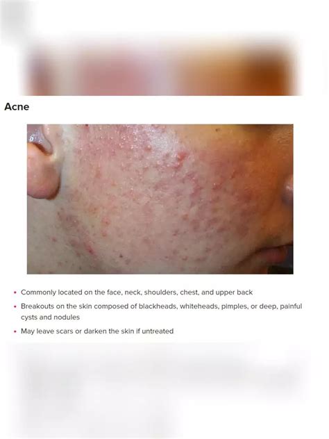 Skin Diseases List With Pictures Pdf Instapdf