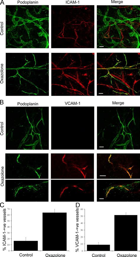 In Vivo Expression Of Icam And Vcam In Mouse Dermal Lymphatics