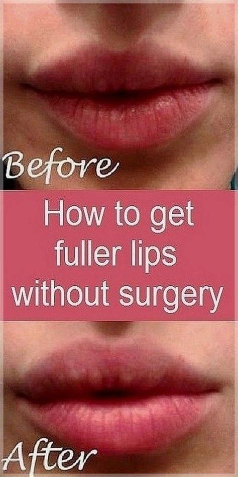 How To Get Fuller And Better Lips Without Surgery Dailygreenhouse