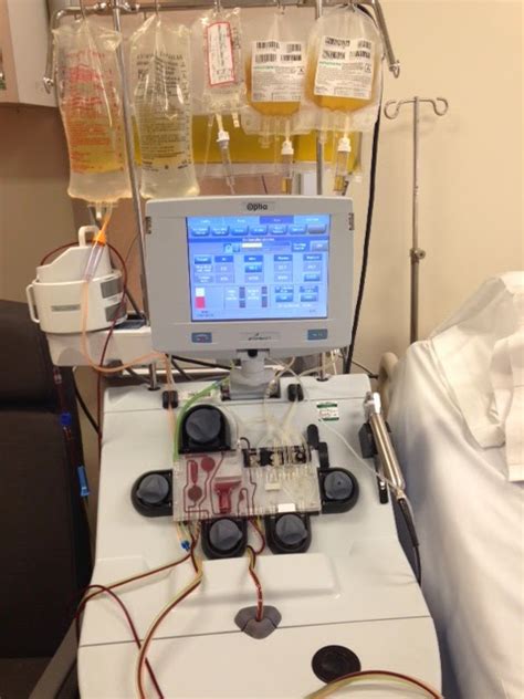 Answering Ttp Thrombotic Thrombocytopenic Purpura Apheresis Treatment