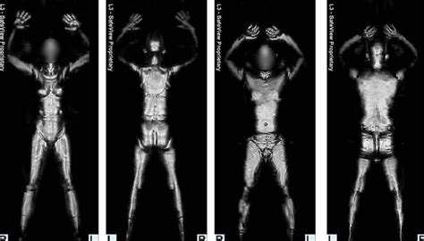 A Front And Back Millimeter Wave Whole Body Imaging Results From