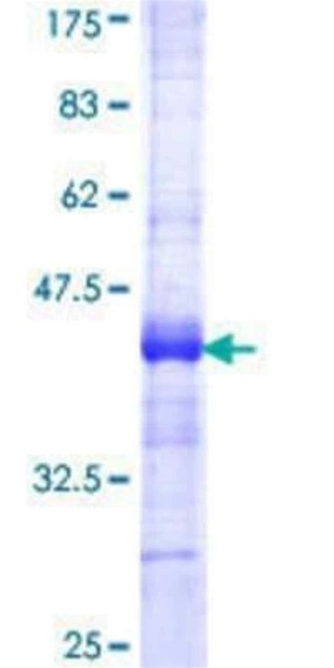 Novus Biologicals Recombinant Human Acetyl Coa Carboxylase Alpha Acaca