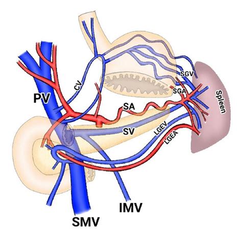 A Normal Anatomy The Splenic Inflows And Outflows Are Balanced B