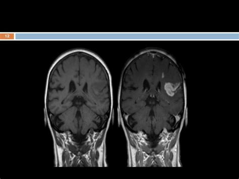 Mri contrast