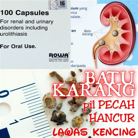 Urolithiasis Urinary Disorders Ubat Batu Karang Dan Untuk Jangkitan