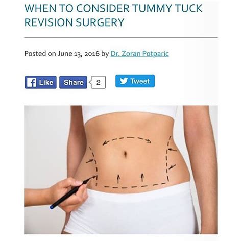 I often treat patients who have gotten a tummy tuck elsewhere and who ...