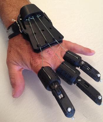 Hand Up 3D printed Prosthetic Project - 3D Printing Industry