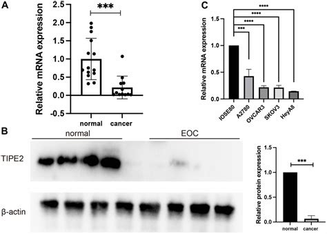 Tipe Acts As A Tumor Suppressor And Correlates With Tumor