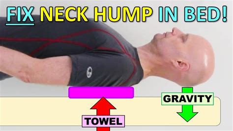 Best System To Fix Neck Hump Forward Head Posture Hunchback In Bed