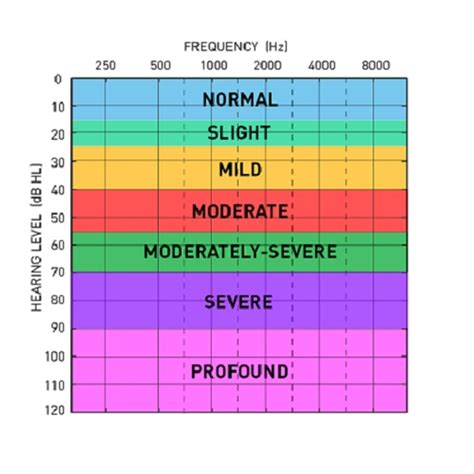 Hearing Loss And The Audiogram Explained