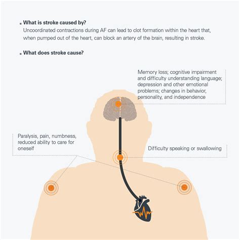 Why Should You Get Treated For Atrial Fibrillation