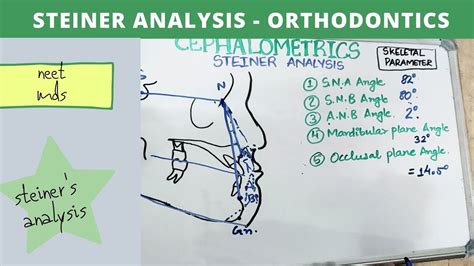 Steiner Analysis Cephalometric Orthodontics Lecture Notes Youtube