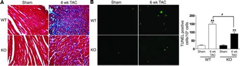 Jci Requirement For Ca2 Calmodulin Dependent Kinase Ii In The Transition From Pressure