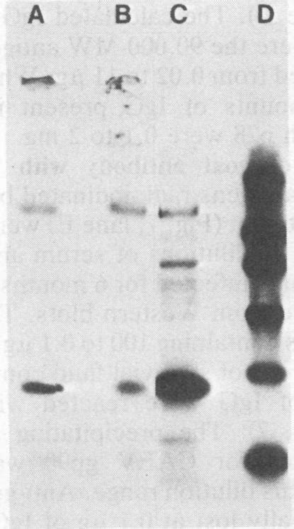 Immunoprecipitation Of 35s Methioninelabeled Caev By Serum Lane A