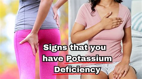 12 Signs That You Have Potassium Deficiency Youtube