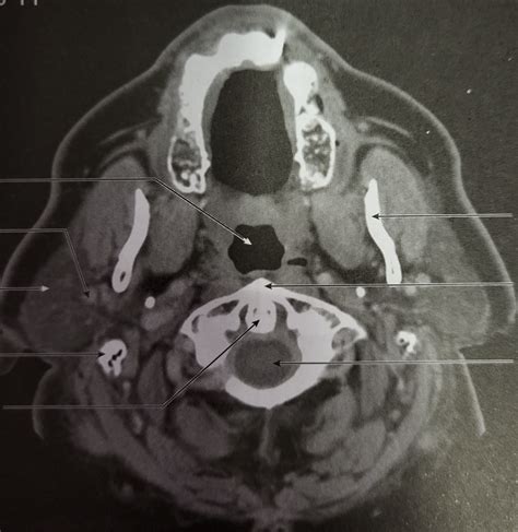 NEUROANATOMY Diagram Quizlet