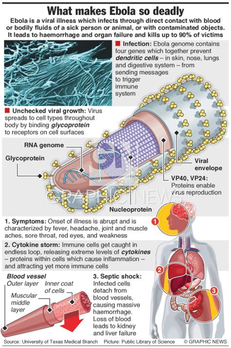 Medical Why Ebola Is So Deadly Infographic