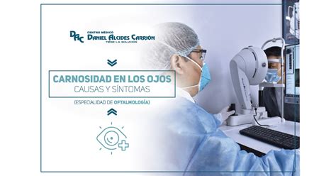 CARNOSIDAD EN LOS OJOS PTERIGIÓN Síntomas y Causas Centro Médico