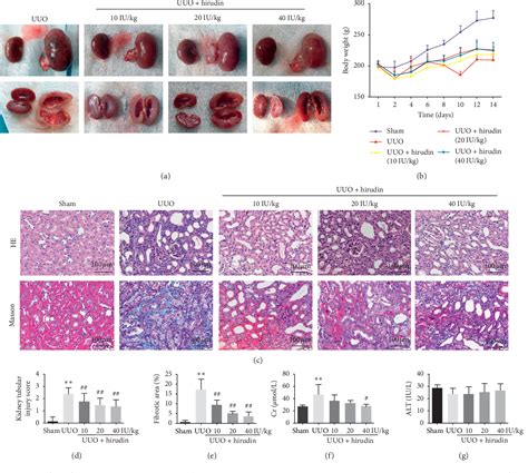 Figure 1 From Hirudin Ameliorates Renal Interstitial Fibrosis Via