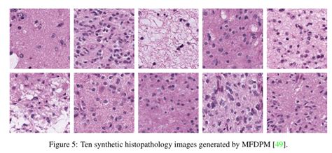 Diffusion Models For Medical Image Analysis A Comprehensive Survey