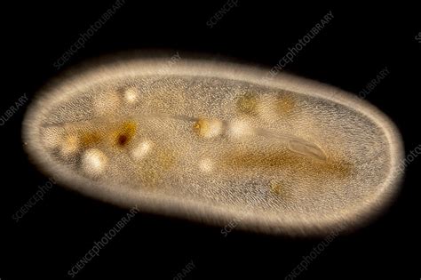 Frontonia Protist Light Micrograph Stock Image C0569402 Science Photo Library