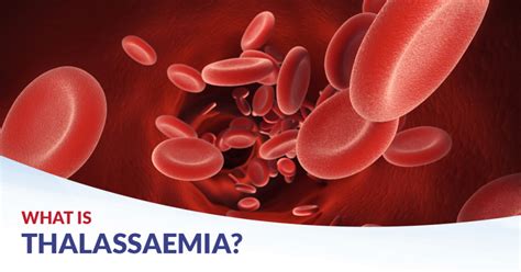 5 Common Thalassaemia Questions Cfch Singapore