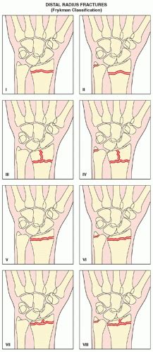 Upper Limb Iii Distal Forearm Wrist And Hand Radiology Key