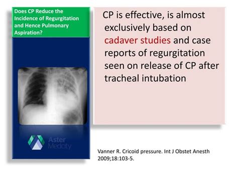 Cricoid pressure -Yes or No?