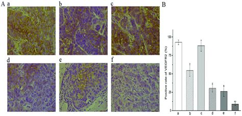 Expression Of Vegfr 2 In Cne 2 Npc Tumor Tissue A Download