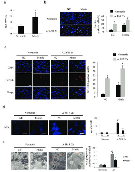 Overexpression Of Mir Enhanced Apoptosis And Autophagy In Cultured