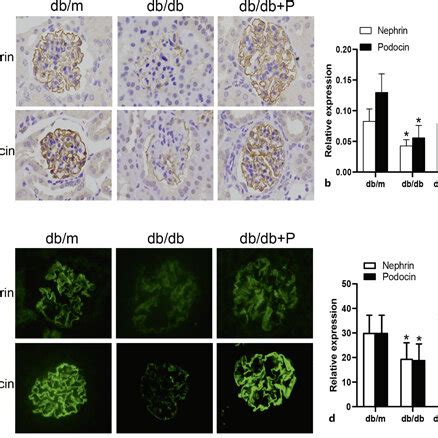 Treatment With Paricalcitol Increased Nephrin And Podocin Expression In