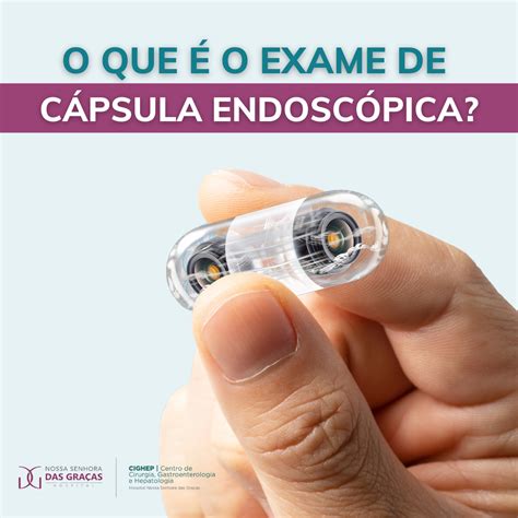 O que é o exame de cápsula endoscópica Cighep