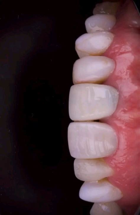 Video Posted By Cl Nica Dental Cevallos Ortodoncia Integral Y