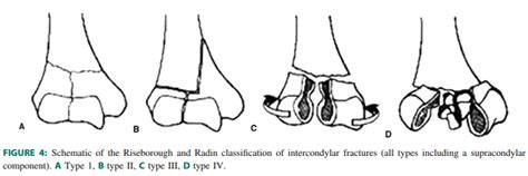 Distal Humerus Fracture - General Components and Differential Diagnosis of the Elbow